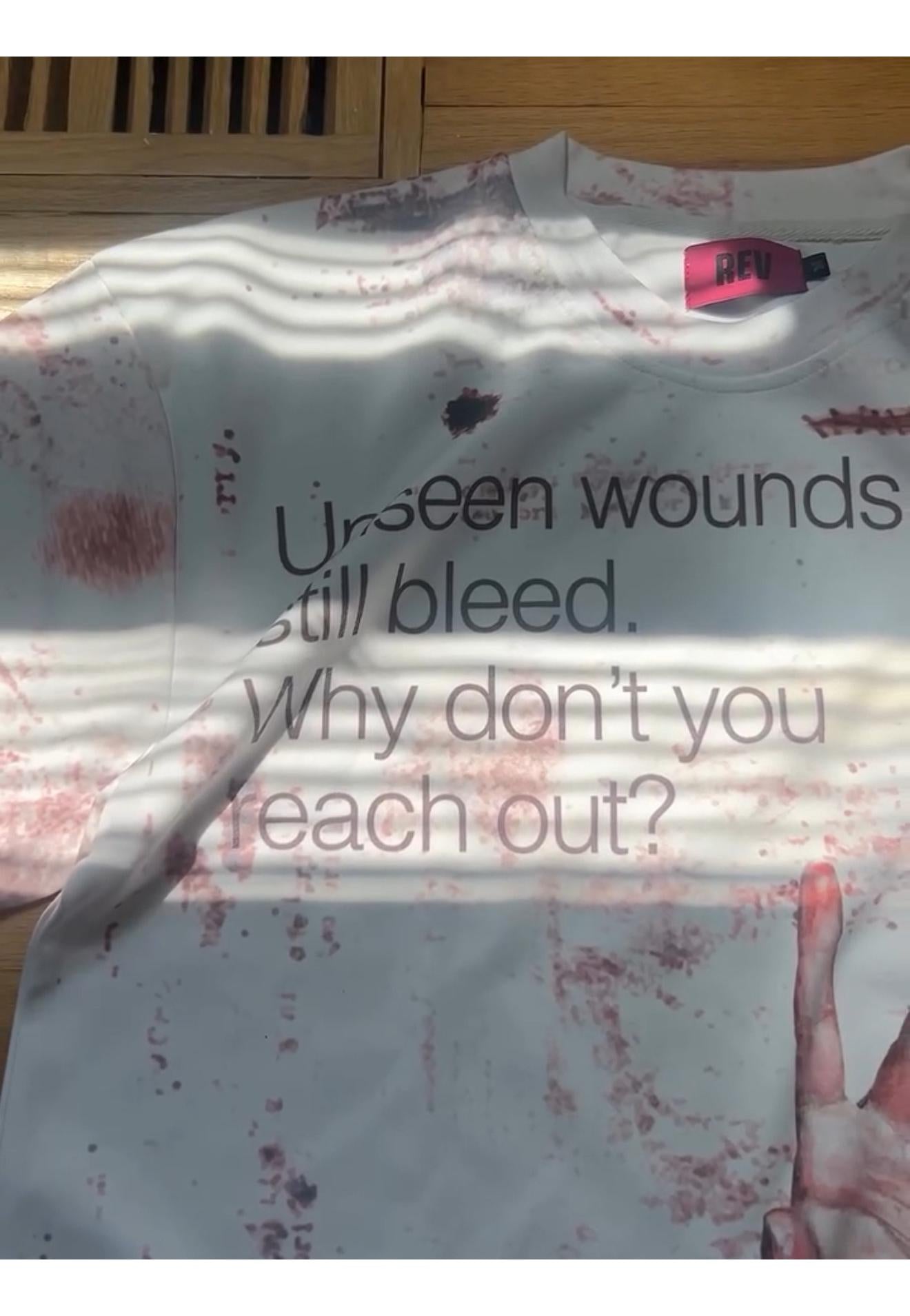 Versai ™ Wounds Shirt